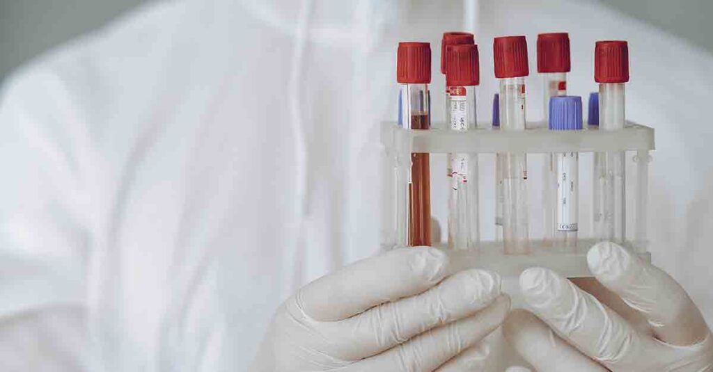 Person holding test tube rack. One test tube is filled with blood drawn from a patient.